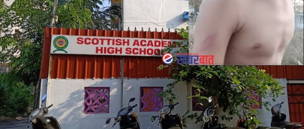 शुल्लक कारणावरून मुख्याध्यापकाची विद्यार्थ्यांना अमानुष मारहाण; नाशकातील स्कॉटीश अकॅडमी शाळेतील प्रकार l headmaster of scottish academy school beats student Nashik